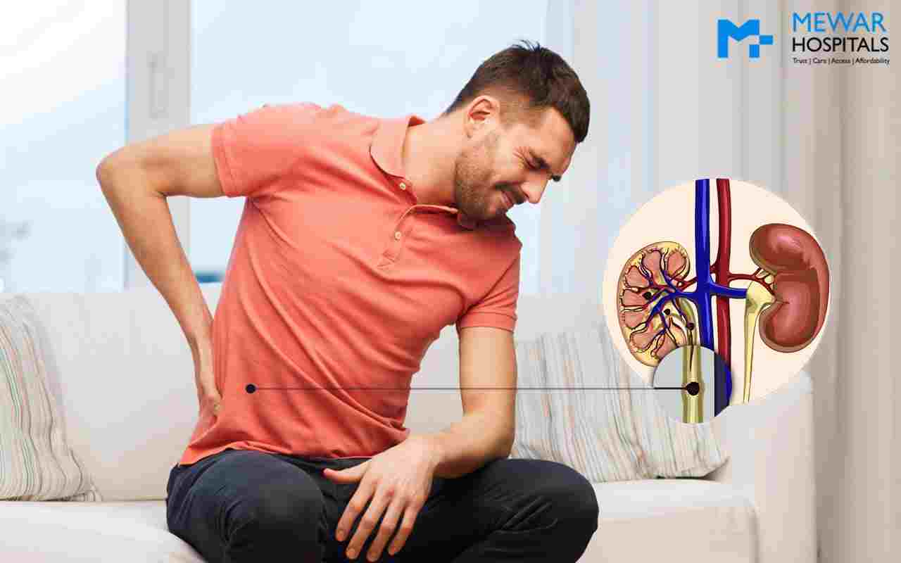 https://www.mewarhospitals.com/wp-content/uploads/2021/11/kidney-stone-causes-symptoms-treatments-min-compressed.jpg
