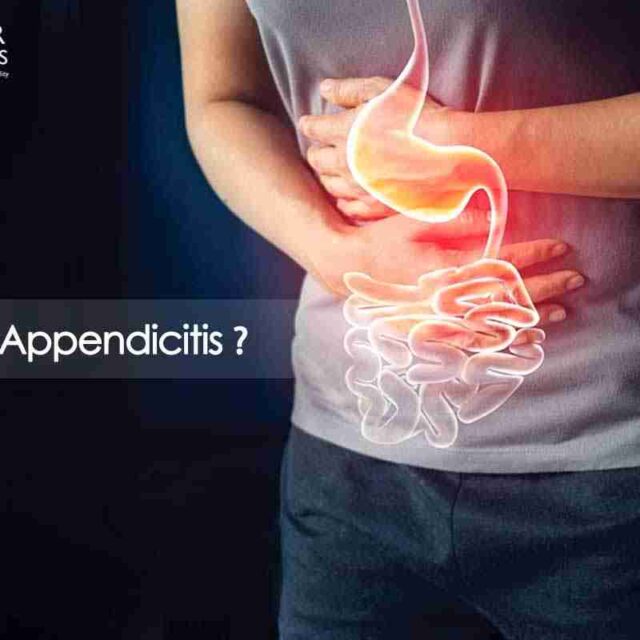 What Is Appendicitis? Know Some Important Things Related To This Condition