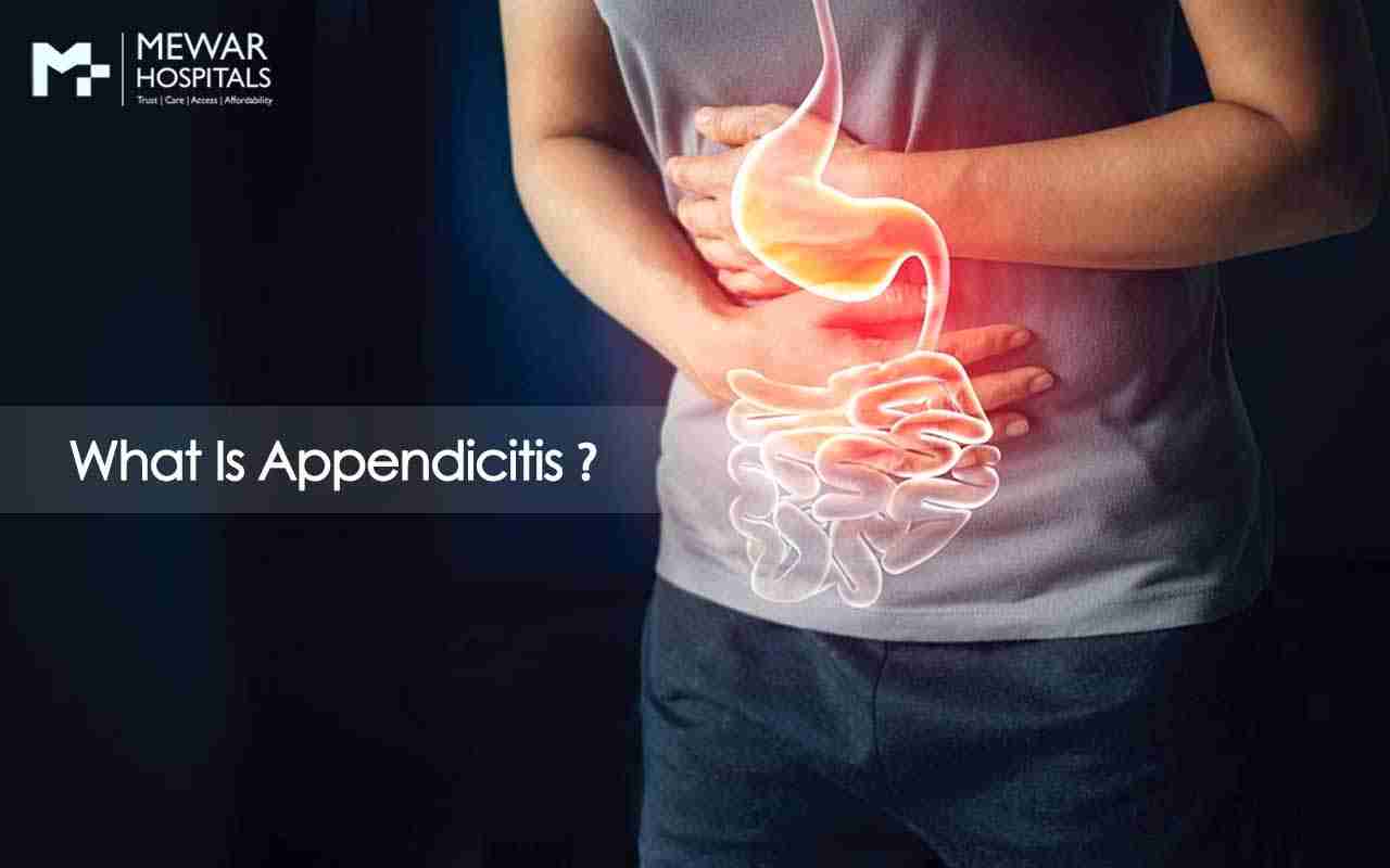 https://www.mewarhospitals.com/wp-content/uploads/2022/02/What-Is-Appendicitis-compressed-1.jpg
