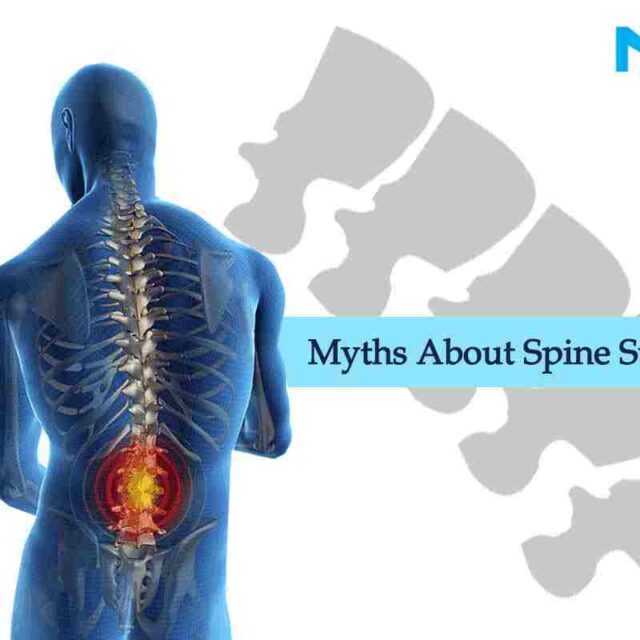 Some Myths About Spine Surgery To Have Knowledge Of