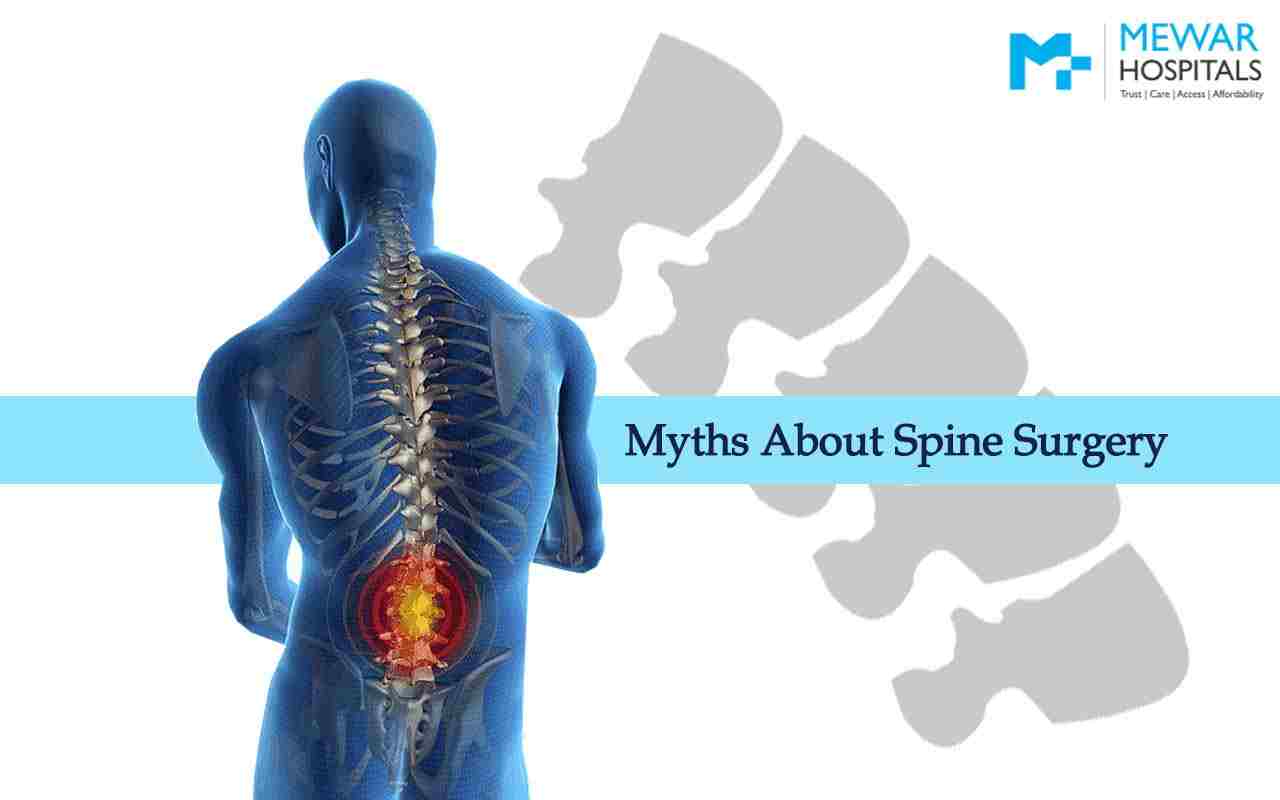 https://www.mewarhospitals.com/wp-content/uploads/2022/08/myths-aboput-spine-surgery-compressed.jpg